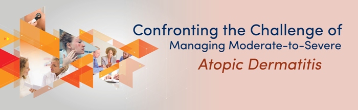 Confronting the Challenge of Managing Moderate-to-Severe Atopic Dermatitis Live Webcast